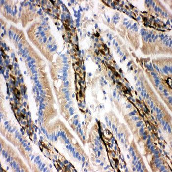 Anti-NRG1 Antibody