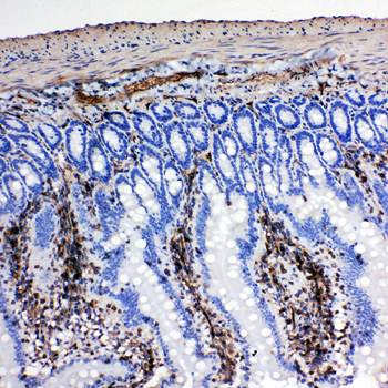 Anti-NRG1 Antibody