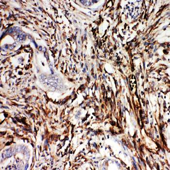 Anti-NRG1 Antibody