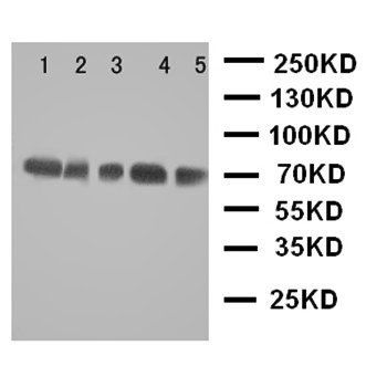 Anti-NRG1 Antibody