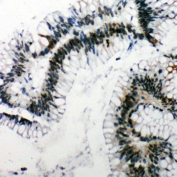 53BP1/TP53BP1 Antibody