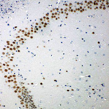 53BP1/TP53BP1 Antibody