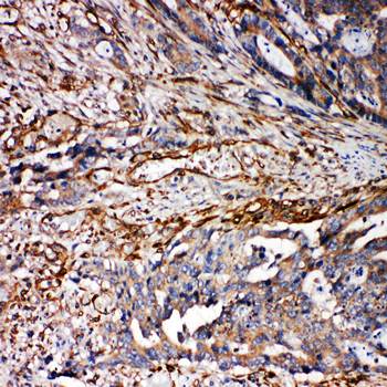 Anti-VRL1/TRPV2 Antibody