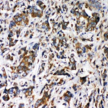 Anti-VRL1/TRPV2 Antibody