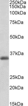 Goat anti-MDH1 / MOR2 (aa211-223) Antibody