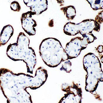 Anti-Growth Hormone/GH1 Antibody