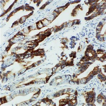 Anti-Cytochrome P450 2U1 CYP2U1 Antibody