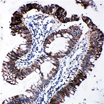 Anti-EIF2S1 Antibody