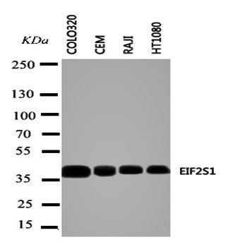 Anti-EIF2S1 Antibody