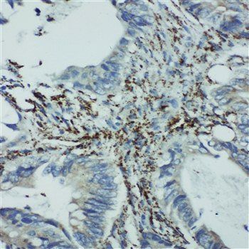 Anti-integrin beta 4 binding protein/EIF6 Antibody