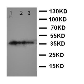 Anti-MBD4 Antibody