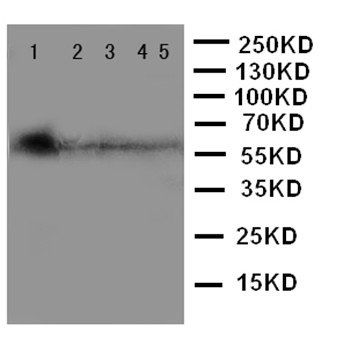 Anti-MBD4 Antibody