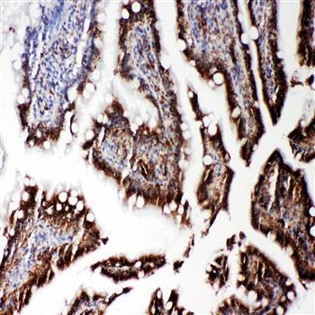 Anti-RGS3 Antibody