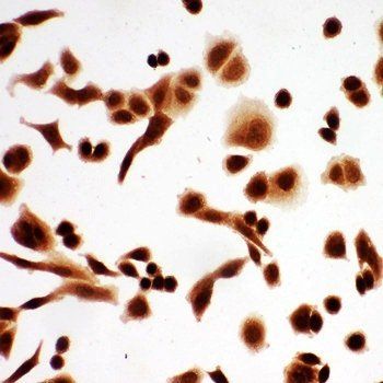 Anti-p63/TP63 Antibody
