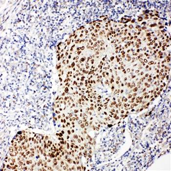 Anti-p63/TP63 Antibody