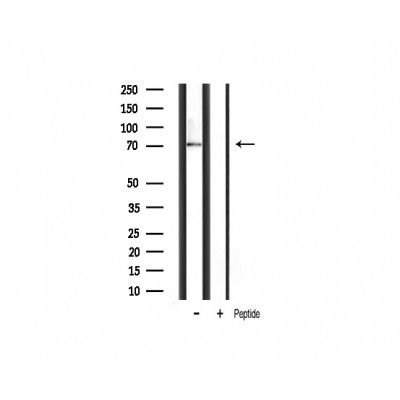 p70 S6 Kinase antibody