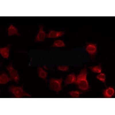 Tuberin/TSC2 antibody
