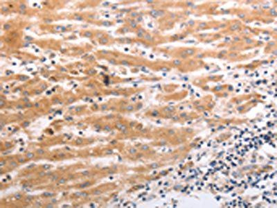HCRTR1 Antibody