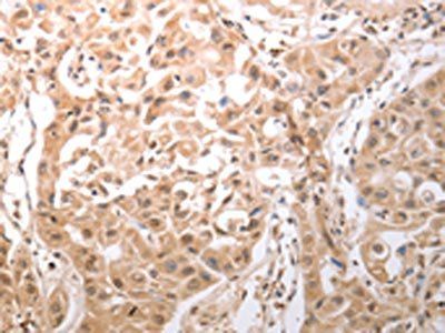 HCRTR1 Antibody