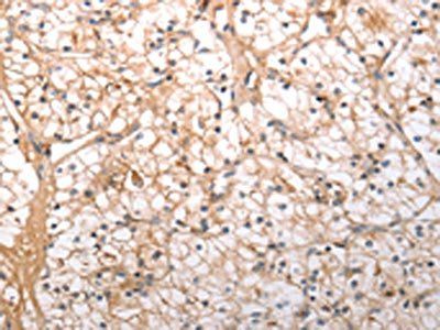 HCRTR1 Antibody