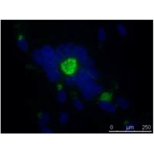 Anti-ORF50 (VZV) antibody