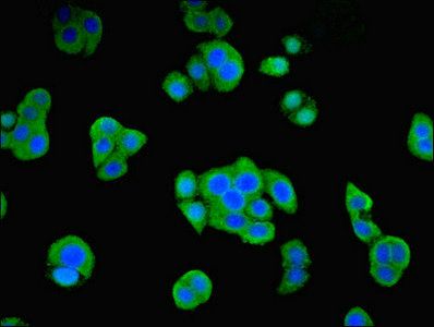 Origin recognition complex subunit 4 antibody