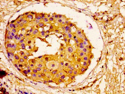 ORM1 Antibody