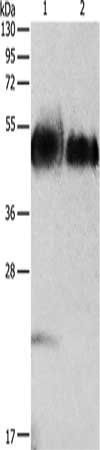 ORM1 antibody