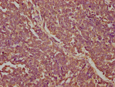 ORM1 Antibody