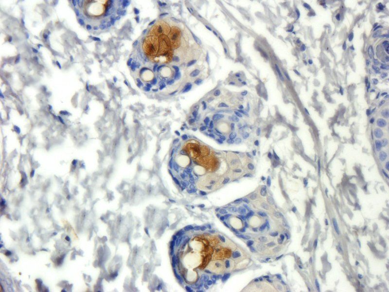 ORM1 antibody