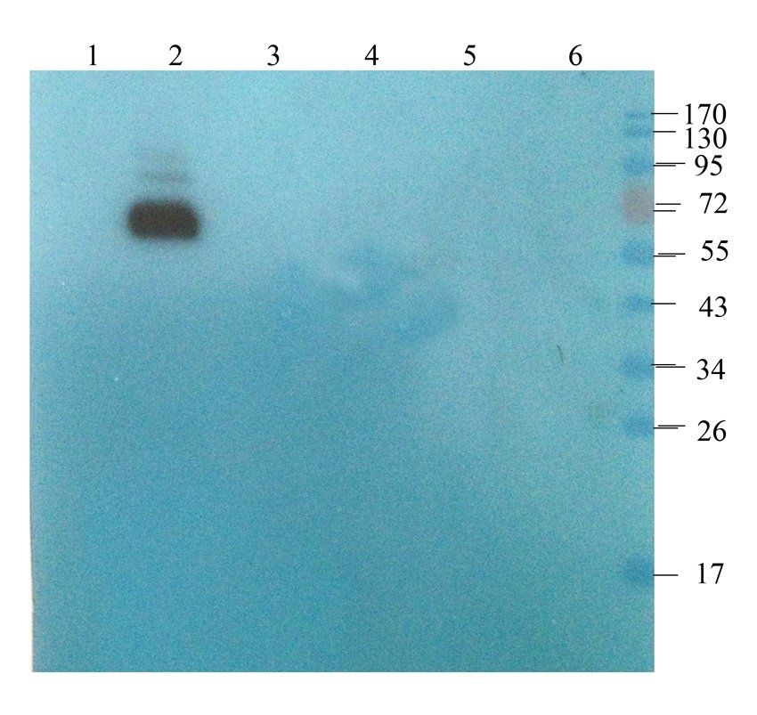 ORM1 antibody