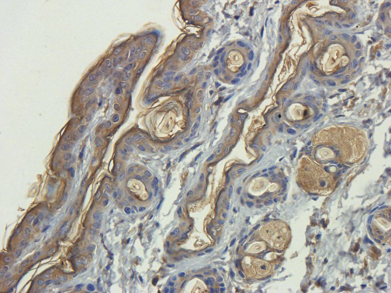 ORM1 antibody