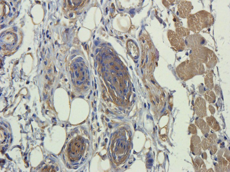 ORM1 antibody