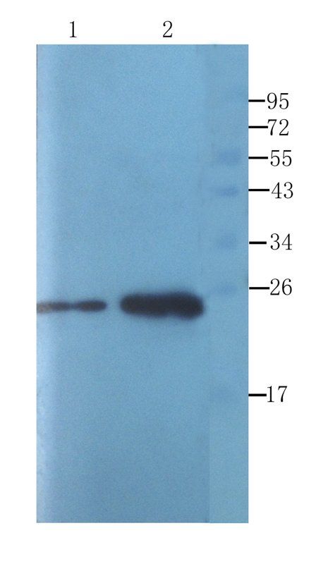 ORM1 antibody