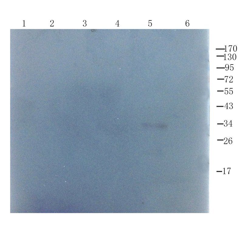 ORM1 antibody