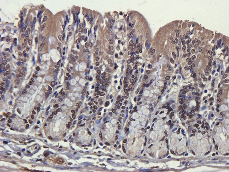 ORM1 antibody