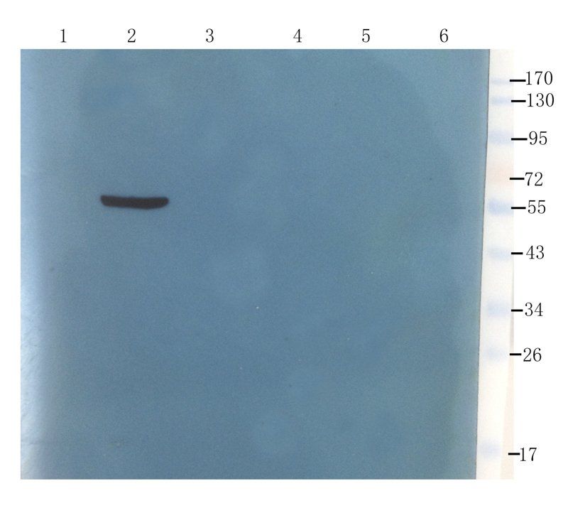 ORM1 antibody