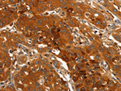 ORM2 Antibody