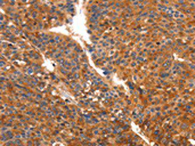 ORM2 antibody