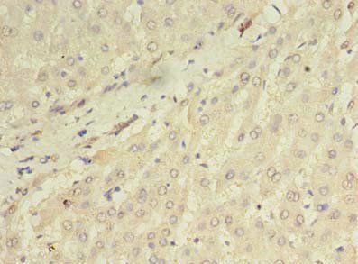 ORMDL1 Antibody