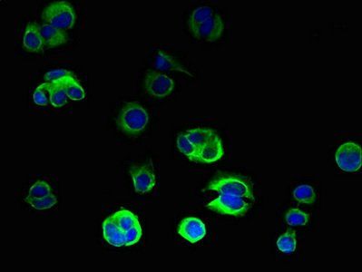ORMDL2 Antibody