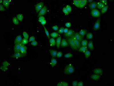 ORMDL3 Antibody