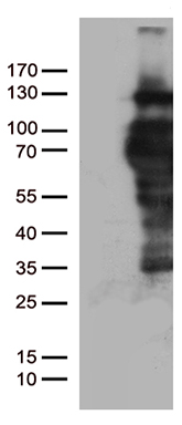 Ornithine Carbamoyltransferase Antibody