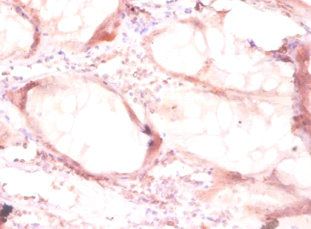 ODC1 Antibody