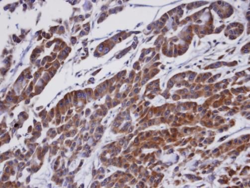 ORP1 antibody [C3], C-term