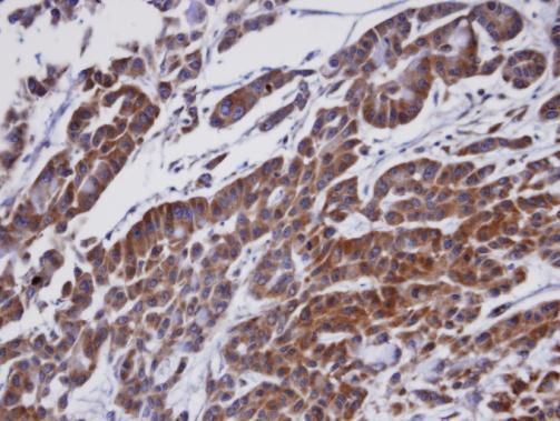 ORP1 antibody