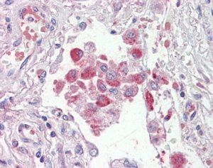 ORP9/OSBPL9 Antibody