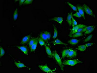 OS9 Antibody