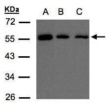 GSTA1 antibody