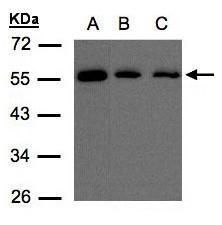 glutathione S-transferase alpha 1 Antibody